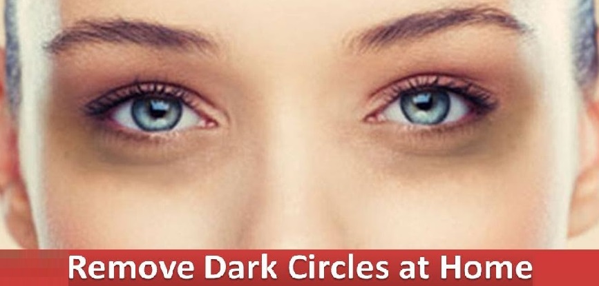 home remedies for dark circles under eyes